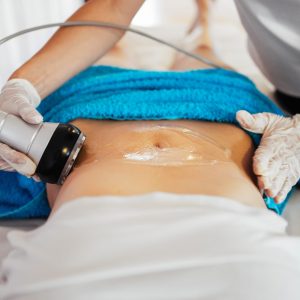 Cavitation RF body treatment and contemporary medicine for health beauty improvement and fat and cellulite removal